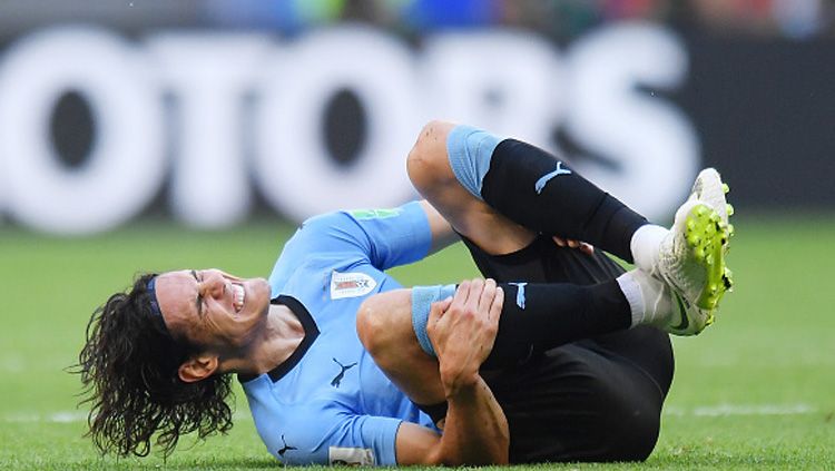 Striker Timnas Uruguay, Edinson Cavani meringis kesakitan karena cedera. Copyright: © Getty Images