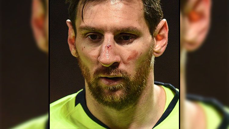 Hidung Lionel Messi berdarah setelah Bertabrakan dengan Smalling (11/4/2019). Copyright: © LINE/Extra Time