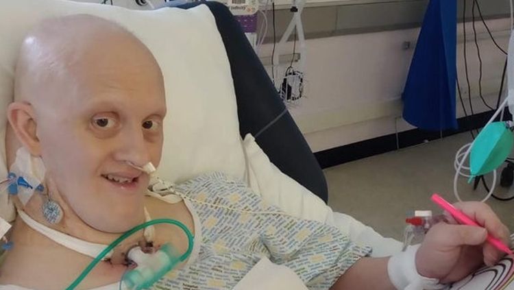 Eks pebulutangkis Craig Sharratt berhasil melewati fase sulit melawan virus Corona setelah menghabiskan waktu tujuh minggu di ICU. Copyright: © thesouthernreporter.co.uk