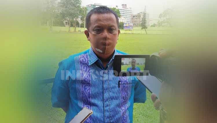 Mulyadi Simatupang memberi penjelasan hasil rapid test virus corona yang dijalani pemain klub Liga 2 PSMS Medan. Copyright: © Aldi Aulia Anwar/INDOSPORT