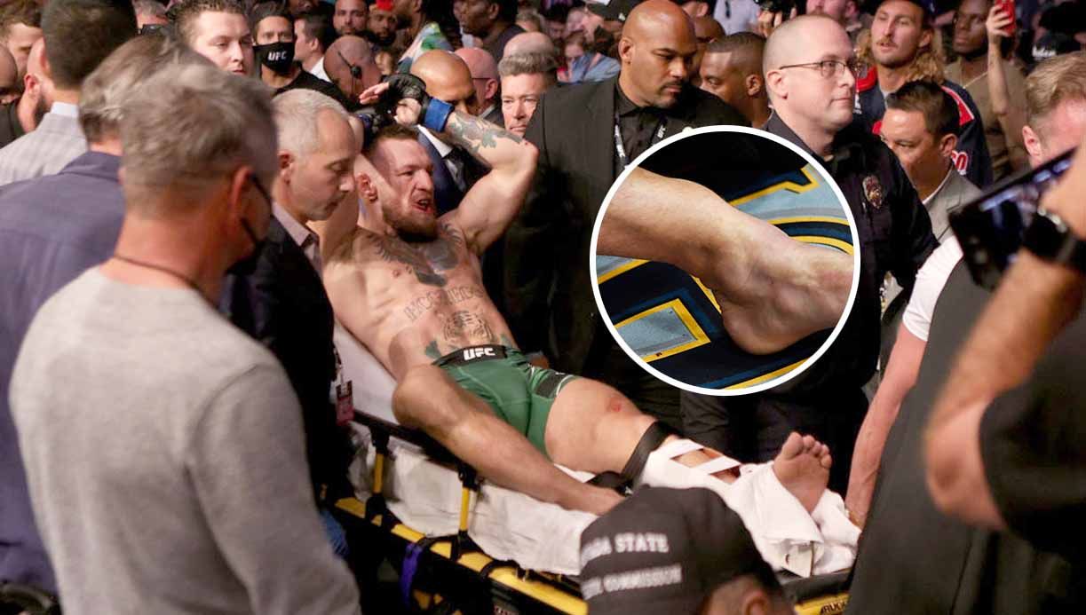 Conor McGregor saat ditandu keluar karena mengalami insiden patah kaki. Copyright: © Stacy Revere/Getty Images
