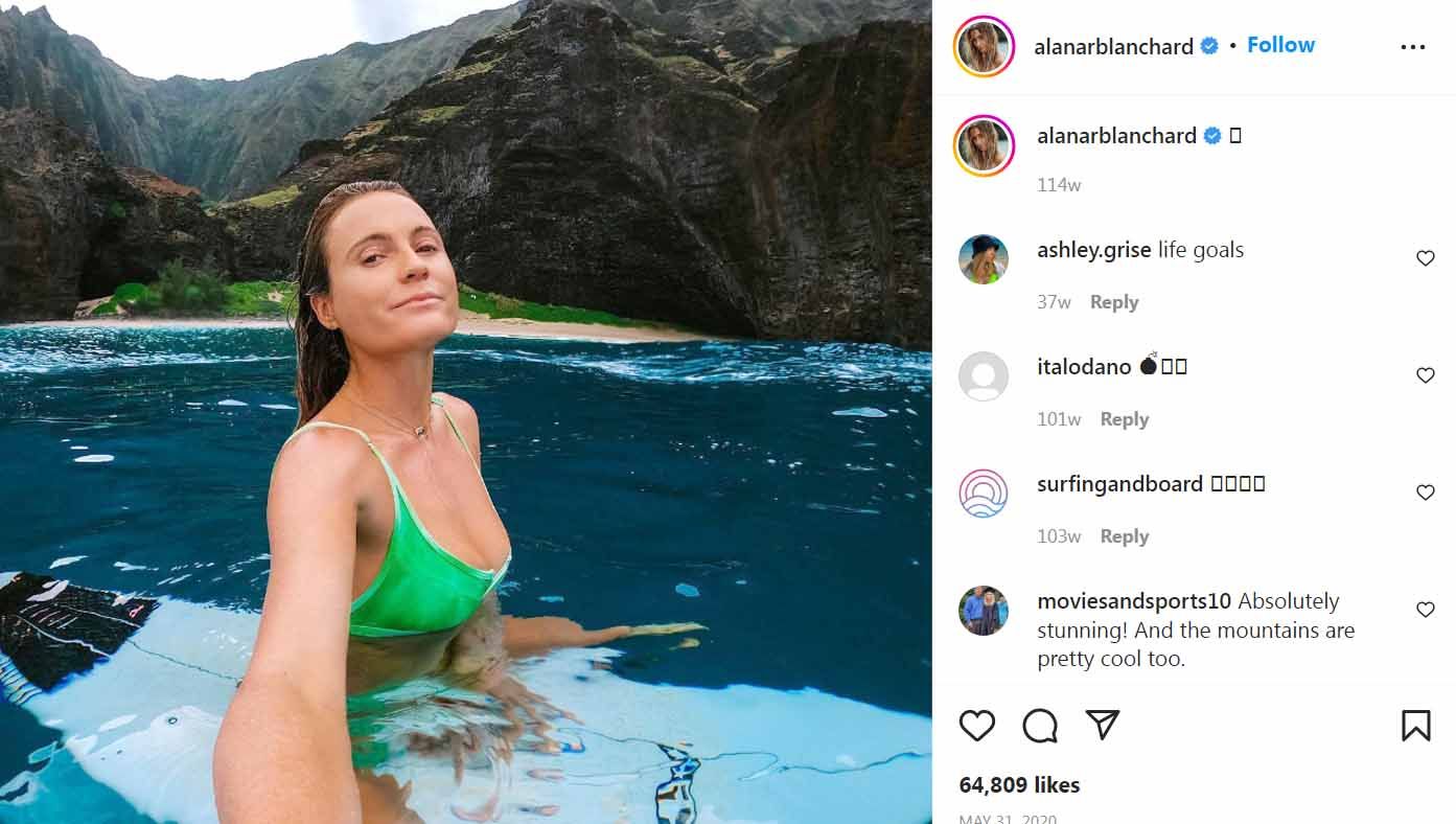 Sufer cantik asal Amerika Serikat, Alana Blanchard. Foto: Instagram@alanarblanchard. Copyright: © Instagram@alanarblanchard