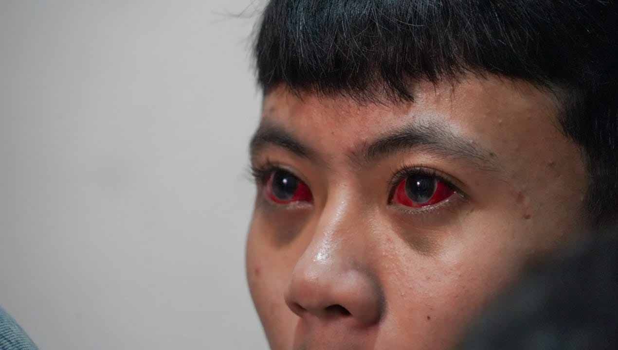 Kondisi para korban Tragedi Kanjuruhan. (Foto: dokumentasi TGIPF) Copyright: © dokumentasi TGIPF